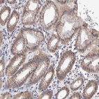 Immunohistochemical staining of human stomach shows moderate cytoplasmic positivity in glandular cells.
