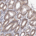 Immunohistochemical staining of human stomach shows moderate cytoplasmic positivity in glandular cells.