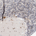 Immunohistochemical staining of human cerebellum shows moderate to strong nuclear positivity in neurons.