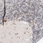 Immunohistochemical staining of human cerebellum shows moderate to strong nuclear positivity in neurons.