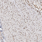 Immunohistochemical staining of human smooth muscle shows strong nuclear positivity in smooth muscle cells.