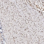 Immunohistochemical staining of human smooth muscle shows strong nuclear positivity in smooth muscle cells.