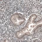 Immunohistochemical staining of human endometrium shows moderate nuclear positivity in glandular cells.