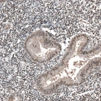 Immunohistochemical staining of human endometrium shows moderate nuclear positivity in glandular cells.