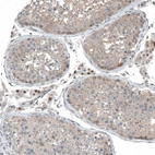 Immunohistochemical staining of human testis shows moderate nuclear positivity in Leydig cells.
