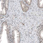 Immunohistochemical staining of human prostate shows moderate nuclear positivity in smooth muscle cells.