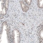 Immunohistochemical staining of human prostate shows moderate nuclear positivity in smooth muscle cells.