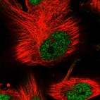 Immunofluorescent staining of human cell line U-251 MG shows localization to nucleoplasm.