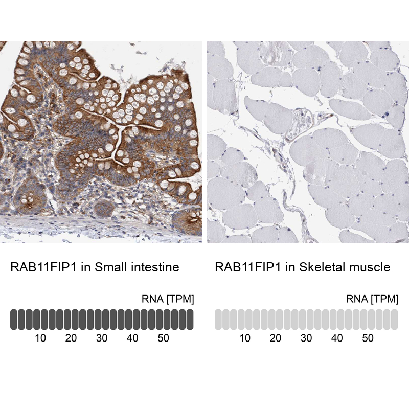 Anti-RAB11FIP1 Antibody