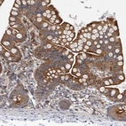 Immunohistochemical staining of human small intestine shows moderate cytoplasmic and membranous positivity in glandular cells.