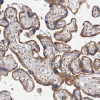 Immunohistochemical staining of human placenta shows moderate granular cytoplasmic positivity in trophoblastic cells.