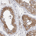 Immunohistochemical staining of human testis shows moderate cytoplasmic positivity in cells in seminiferous ducts.