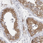 Immunohistochemical staining of human testis shows moderate cytoplasmic positivity in cells in seminiferous ducts.