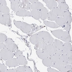 Immunohistochemical staining of human skeletal muscle shows no positivity in striated muscle fibers as expected.