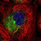 Immunofluorescent staining of human cell line A-431 shows localization to vesicles.