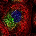 Immunofluorescent staining of human cell line A-431 shows localization to vesicles.