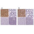 Immunohistochemical staining of human cerebral cortex, colon, liver and pancreas using Anti-NECAB1 antibody HPA025963 (A) shows similar protein distribution across tissues to independent antibody HPA023629 (B).