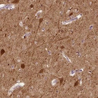 Immunohistochemical staining of human cerebral cortex shows strong cytoplasmic positivity in neurons.