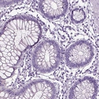 Immunohistochemical staining of human colon shows no positivity in glandular cells as expected.