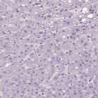 Immunohistochemical staining of human liver shows no positivity in hepatocytes as expected.