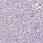 Anti-NECAB1 Antibody