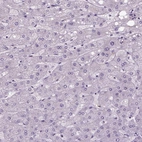 Immunohistochemical staining of human liver shows no positivity in hepatocytes as expected.