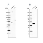 Western blot analysis using Anti-NECAB1 antibody HPA025963 (A) shows similar pattern to independent antibody HPA023629 (B).