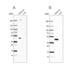 Western blot analysis using Anti-NECAB1 antibody HPA025963 (A) shows similar pattern to independent antibody HPA023629 (B).