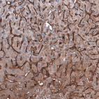 Anti-SLC10A5 Antibody