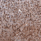 Anti-SLC10A5 Antibody