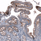 Immunohistochemical staining of human duodenum shows moderate granular cytoplasmic positivity in glandular cells.
