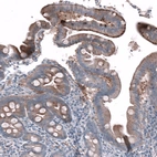 Immunohistochemical staining of human duodenum shows moderate granular cytoplasmic positivity in glandular cells.