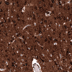 Immunohistochemical staining of human cerebral cortex shows strong cytoplasmic positivity in neurons.