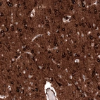 Immunohistochemical staining of human cerebral cortex shows strong cytoplasmic positivity in neurons.