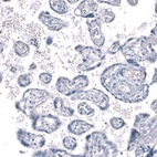 Immunohistochemical staining of human placenta shows no positivity in trophoblastic cells as expected.