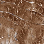 Immunohistochemical staining of human skeletal muscle shows strong cytoplasmic positivity in myocytes.