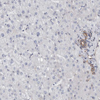 Immunohistochemical staining of human liver shows no positivity in hepatocytes as expected.