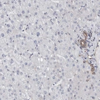 Immunohistochemical staining of human liver shows no positivity in hepatocytes as expected.