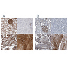 Immunohistochemical staining of human kidney, liver, placenta and skeletal muscle using Anti-PLEC antibody HPA025967 (A) shows similar protein distribution across tissues to independent antibody HPA029906 (B).
