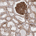 Immunohistochemical staining of human kidney shows strong membranous positivity in cells in glomeruli.