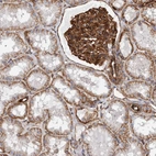 Immunohistochemical staining of human kidney shows strong membranous positivity in cells in glomeruli.