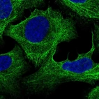 Immunofluorescent staining of human cell line U-2 OS shows localization to cytosol & intermediate filaments.