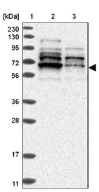 Lane 1: Marker [kDa] 230, 130, 95, 72, 56, 36, 28, 17, 11_br/_Lane 2: Human cell line RT-4_br/_Lane 3: Human cell line U-251MG sp