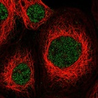 Immunofluorescent staining of human cell line A-431 shows localization to nucleoplasm.