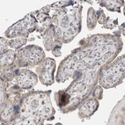Immunohistochemical staining of human placenta shows moderate membranous and cytoplasmic positivity in trophoblastic cells.