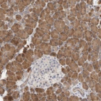 Immunohistochemical staining of human pancreas shows strong cytoplasmic positivity in exocrine glandular cells.