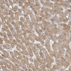 Immunohistochemical staining of human liver shows moderate cytoplasmic positivity in hepatocytes.