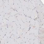Immunohistochemical staining of human skeletal muscle shows no positivity in myocytes as expected.