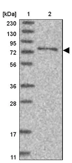 Lane 1: Marker [kDa] 230, 130, 95, 72, 56, 36, 28, 17, 11_br/_Lane 2: Human cell line RT-4
