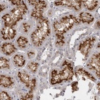 Anti-SLC22A11 Antibody